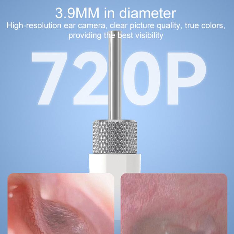 TESLONG SA160 1.45 Inch HD Screen Handheld Smart Visual Otoscope