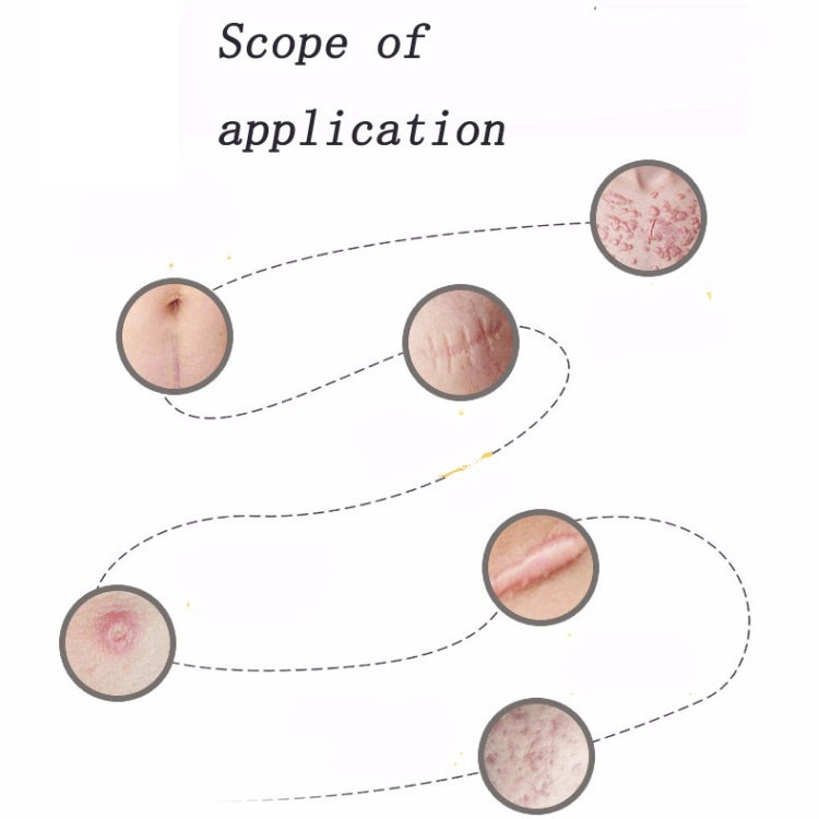 Organic silicone Gel Scar Therapy Patch  be Washed and Reused